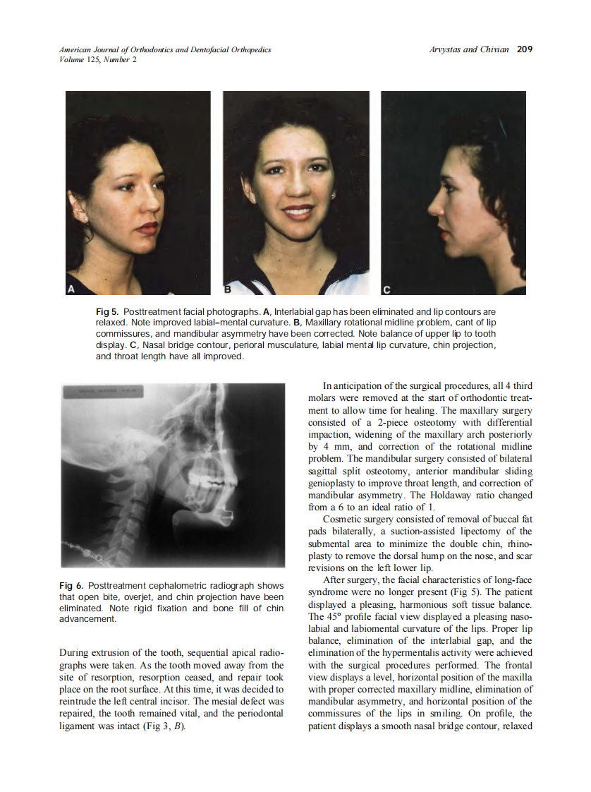 2004_125_2_206_212_Arvystas.pdf 第4页