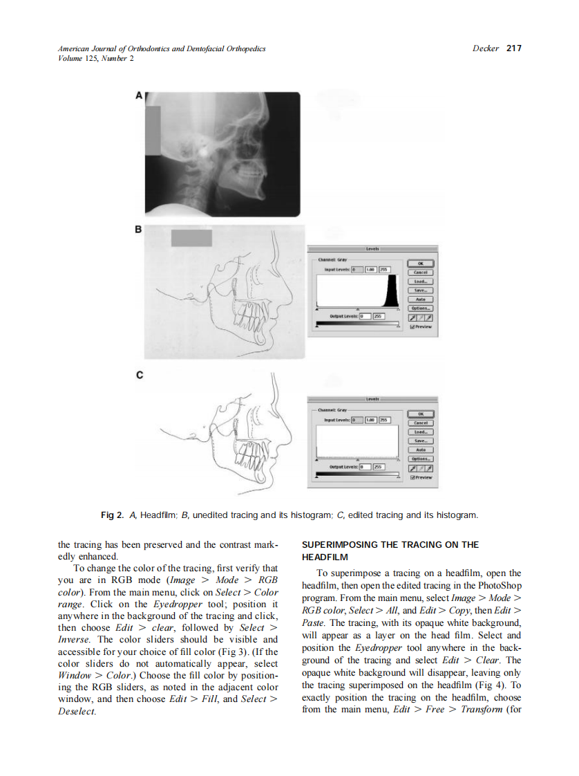 2004_125_2_215_219_Decker.pdf 第3页