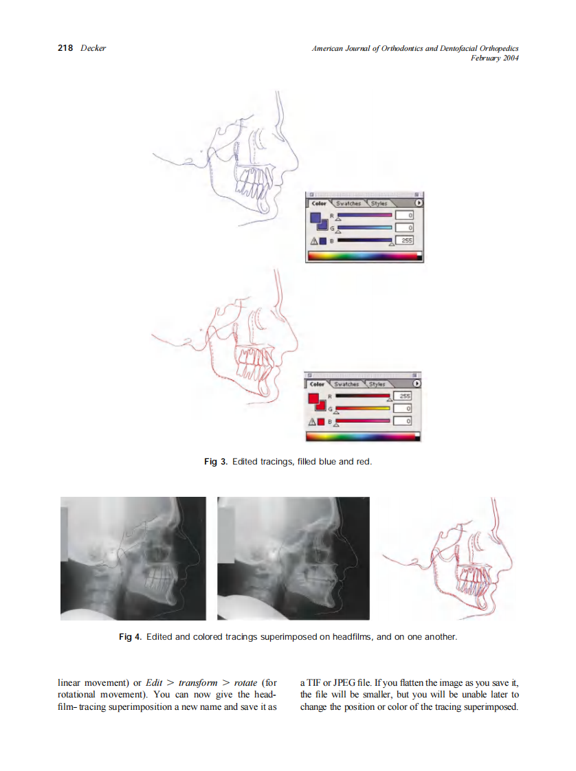 2004_125_2_215_219_Decker.pdf 第4页