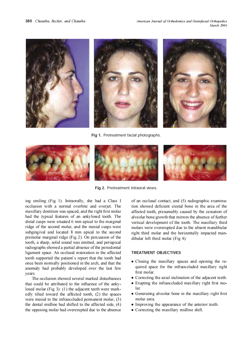 2004_125_3_379_387_Chaushu.pdf 第2页