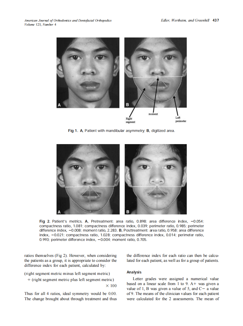 2004_125_4_435_443_Edler.pdf 第3页