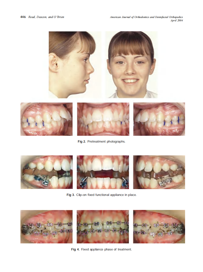 2004_125_4_444_449_Read.pdf 第3页