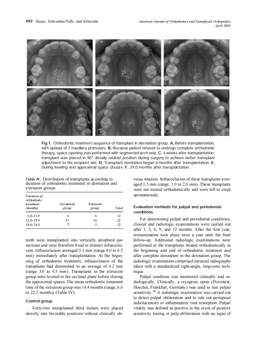 2004_125_4_488_496_Bauss.pdf 第3页