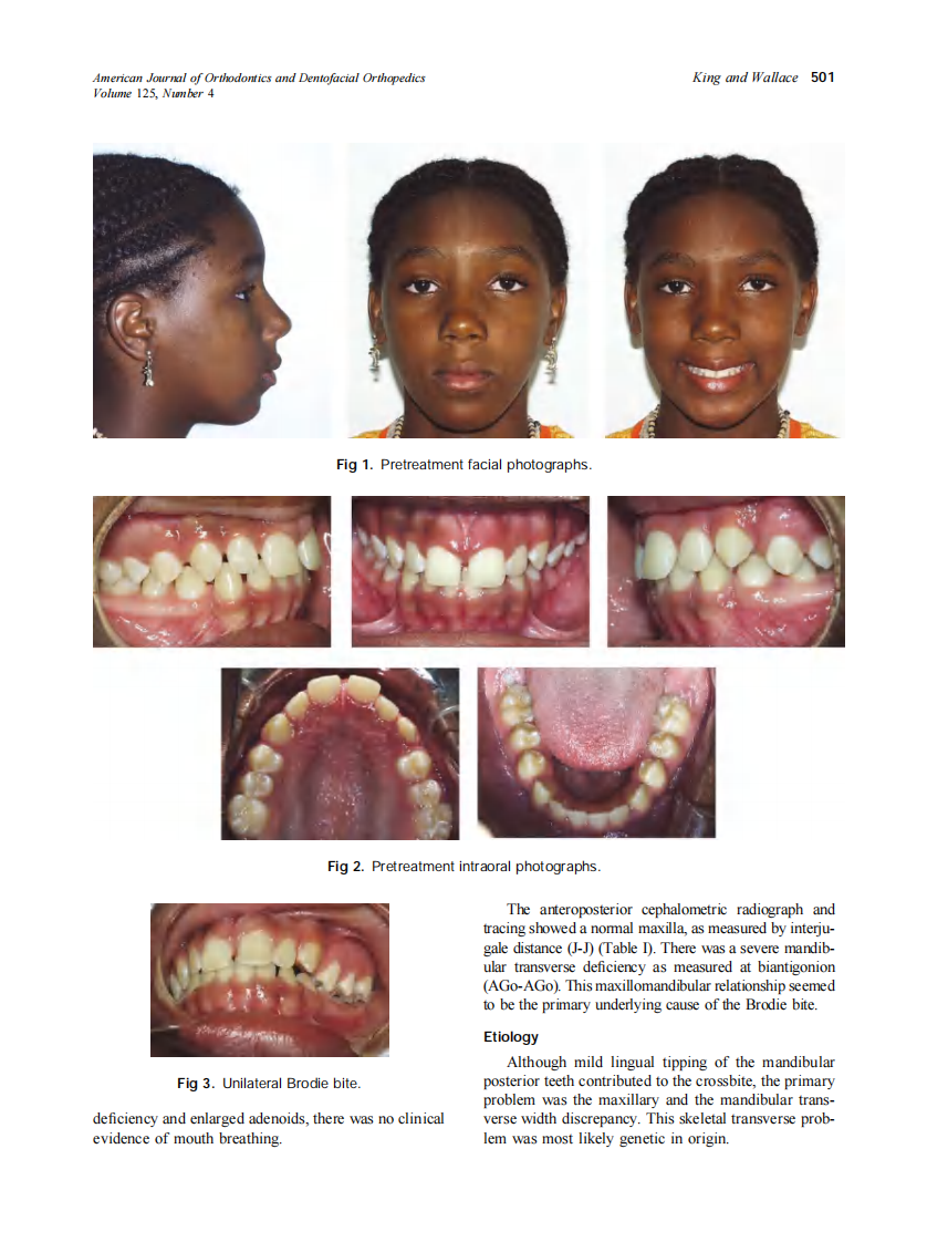 2004_125_4_500_509_King.pdf 第2页