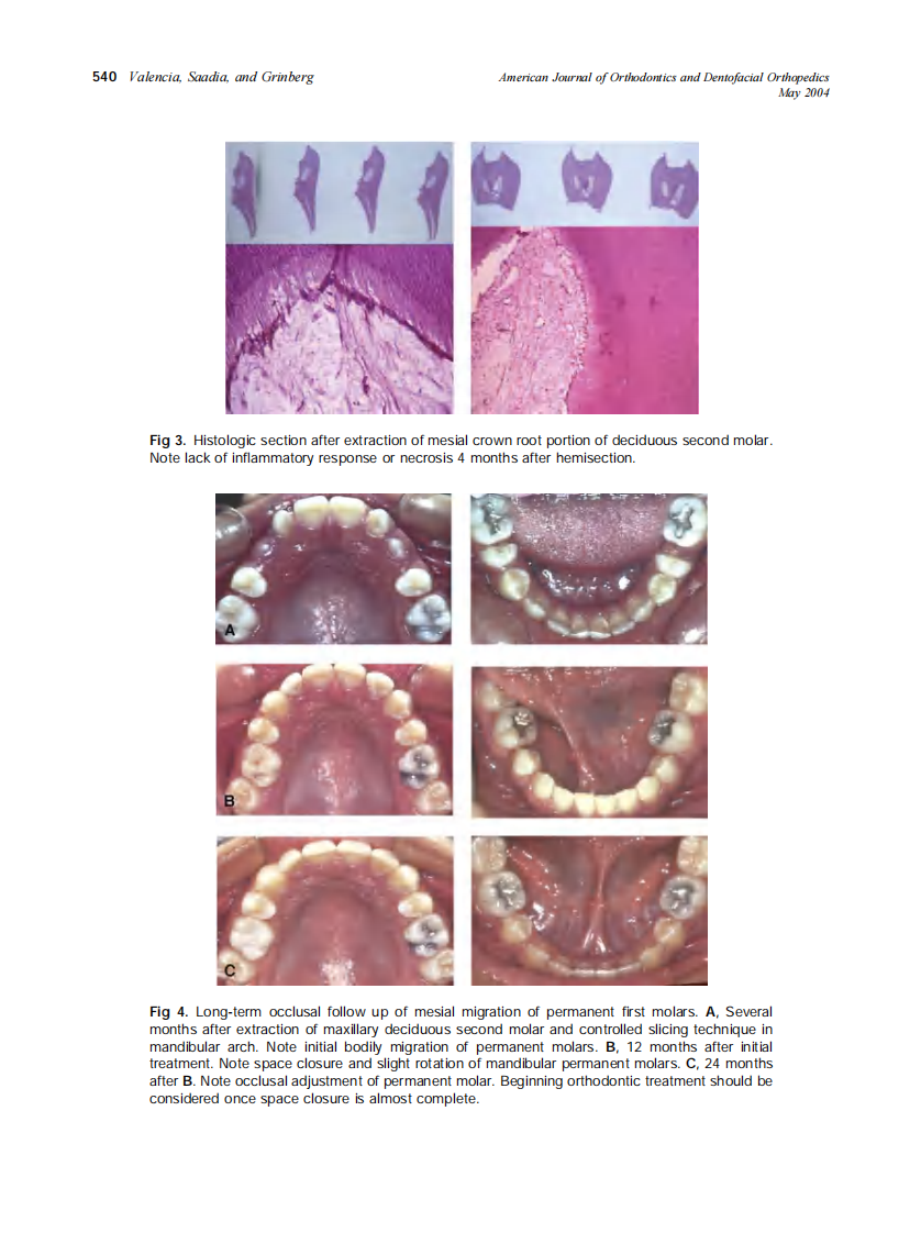 2004_125_5_537_543_Valencia.pdf 第4页