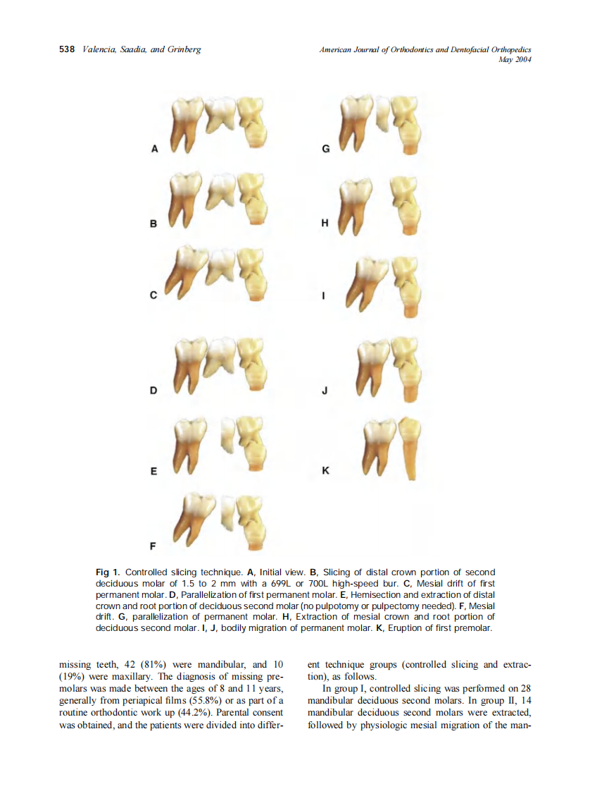 2004_125_5_537_543_Valencia.pdf 第2页