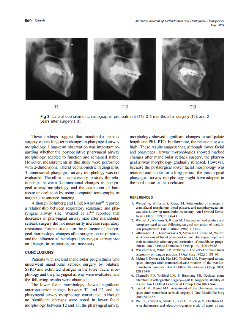2004_125_5_556_561_Saitoh.pdf 第5页