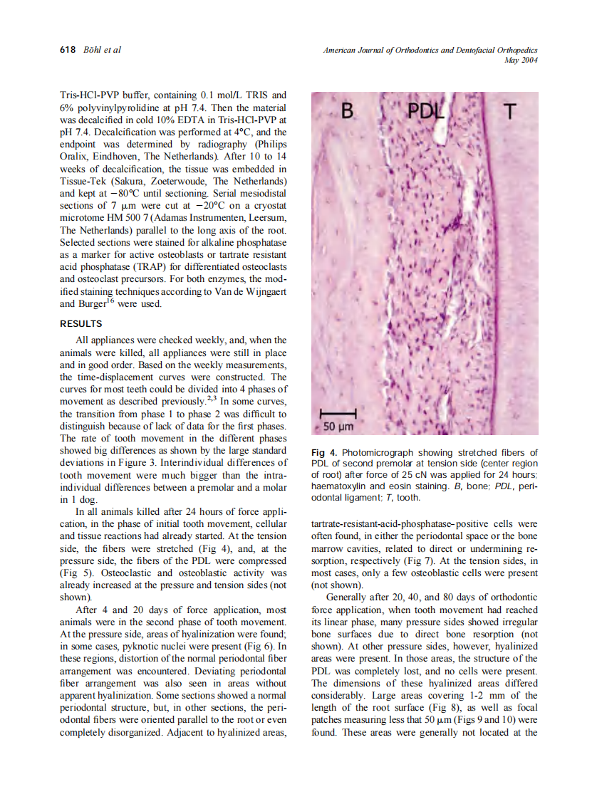 2004_125_5_615_623_Bohl.pdf 第4页