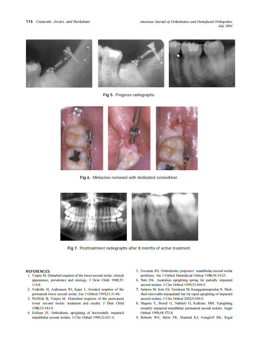 2004_126_1_113_117_Giancotti.pdf 第4页