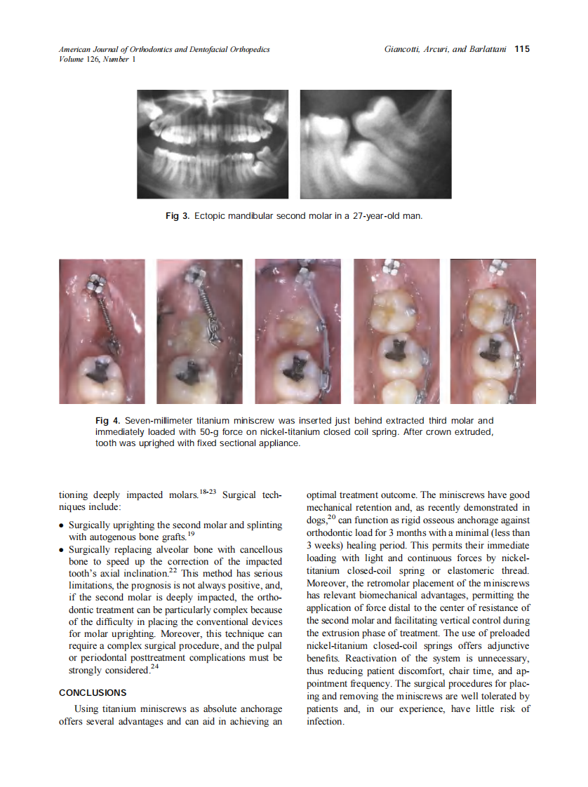 2004_126_1_113_117_Giancotti.pdf 第3页