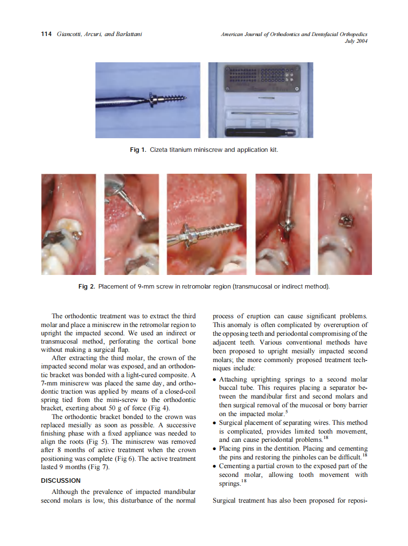 2004_126_1_113_117_Giancotti.pdf 第2页