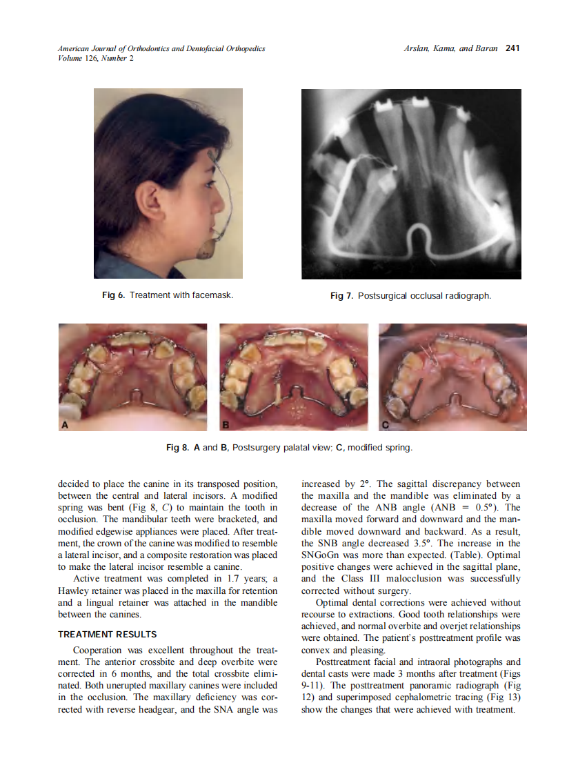 2004_126_2_237_244_Arslan.pdf 第5页