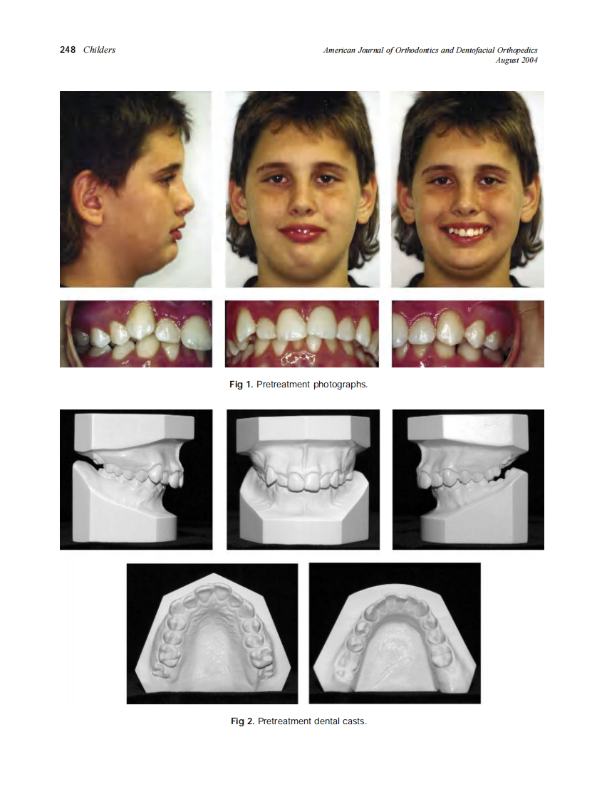 2004_126_2_245_253_Childers.pdf 第4页