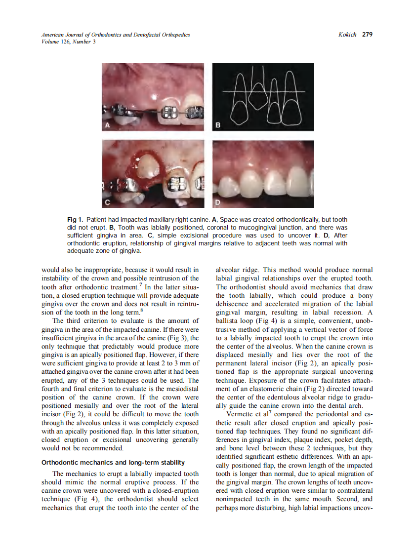 2004_126_3_278_283_Kokich.pdf 第2页