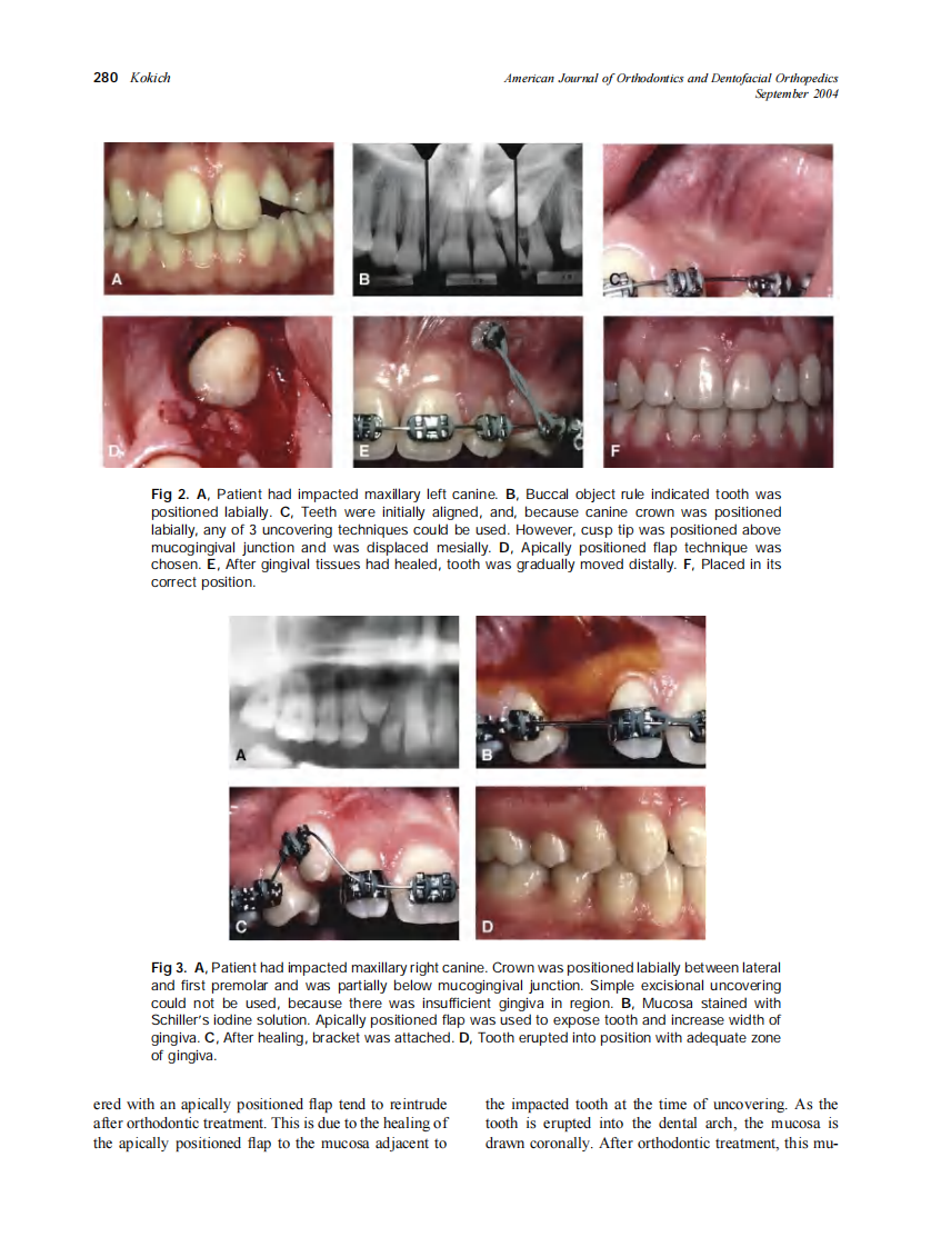 2004_126_3_278_283_Kokich.pdf 第3页