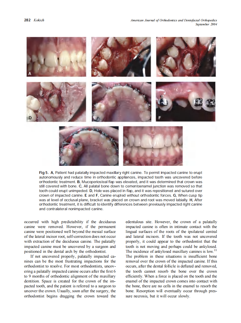 2004_126_3_278_283_Kokich.pdf 第5页