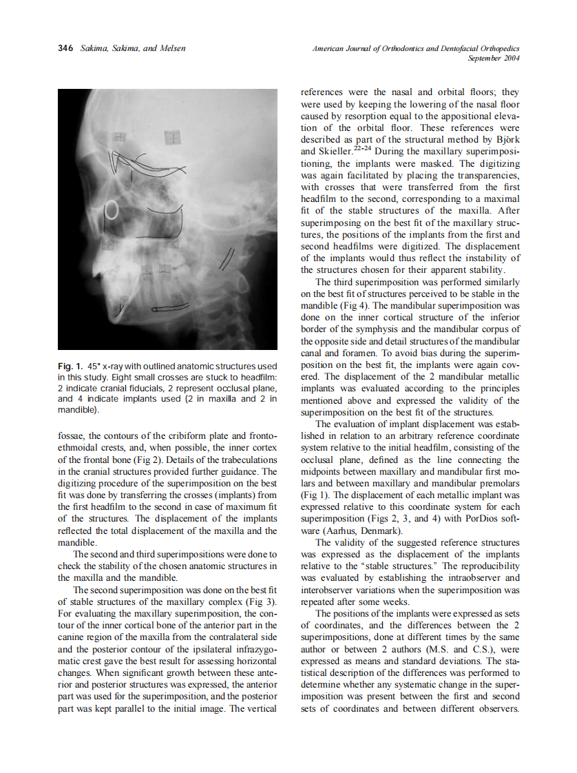 2004_126_3_344_353_Sakima.pdf 第3页