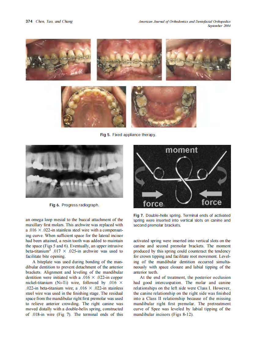 2004_126_3_371_378_Chen.pdf 第4页