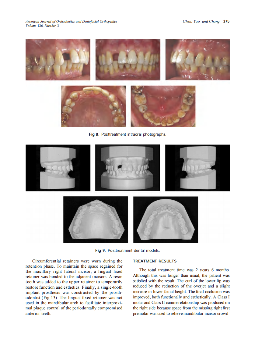 2004_126_3_371_378_Chen.pdf 第5页