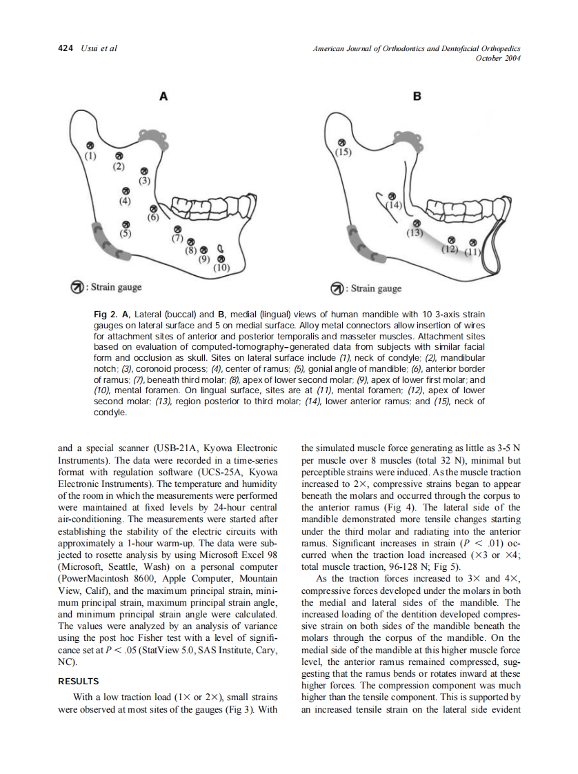 2004_126_4_421_431_Usui.pdf 第4页