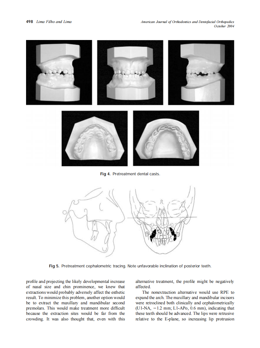 2004_126_4_495_504_Filho.pdf 第3页