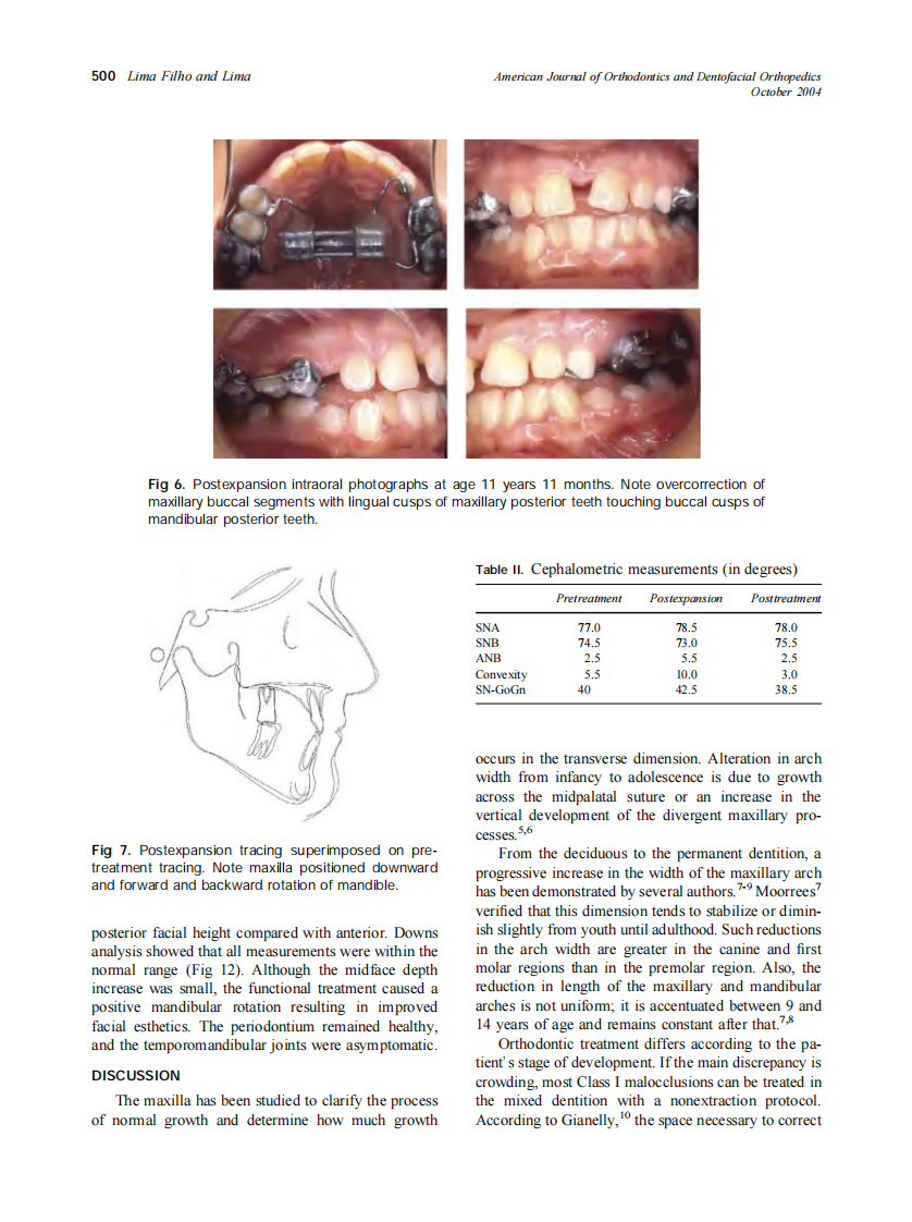 2004_126_4_495_504_Filho.pdf 第5页