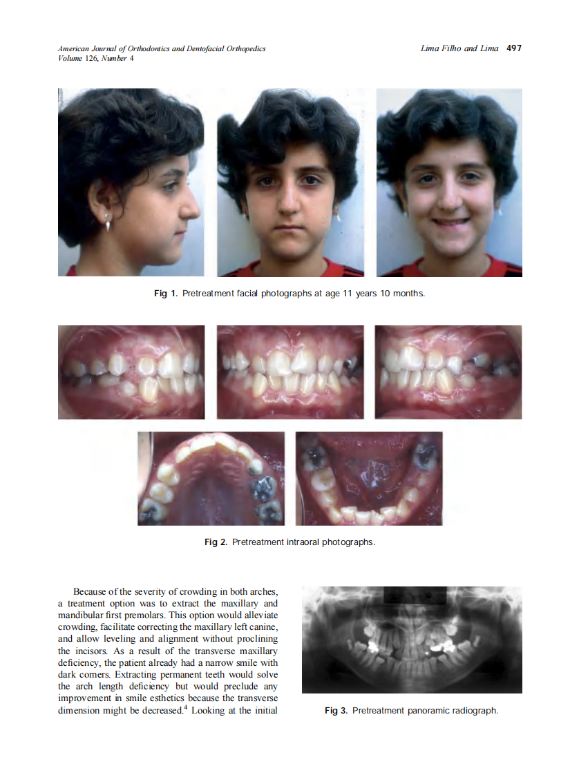 2004_126_4_495_504_Filho.pdf 第2页