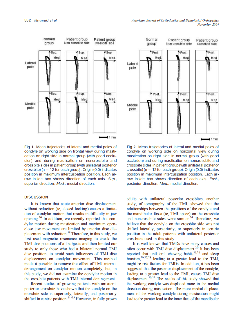 2004_126_5_549_554_Miyawaki.pdf 第4页