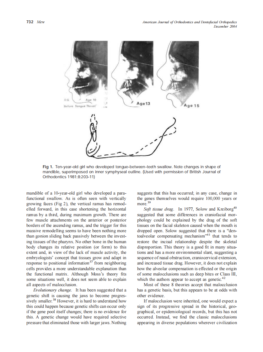 2004_126_6_729_738_Mew.pdf 第4页