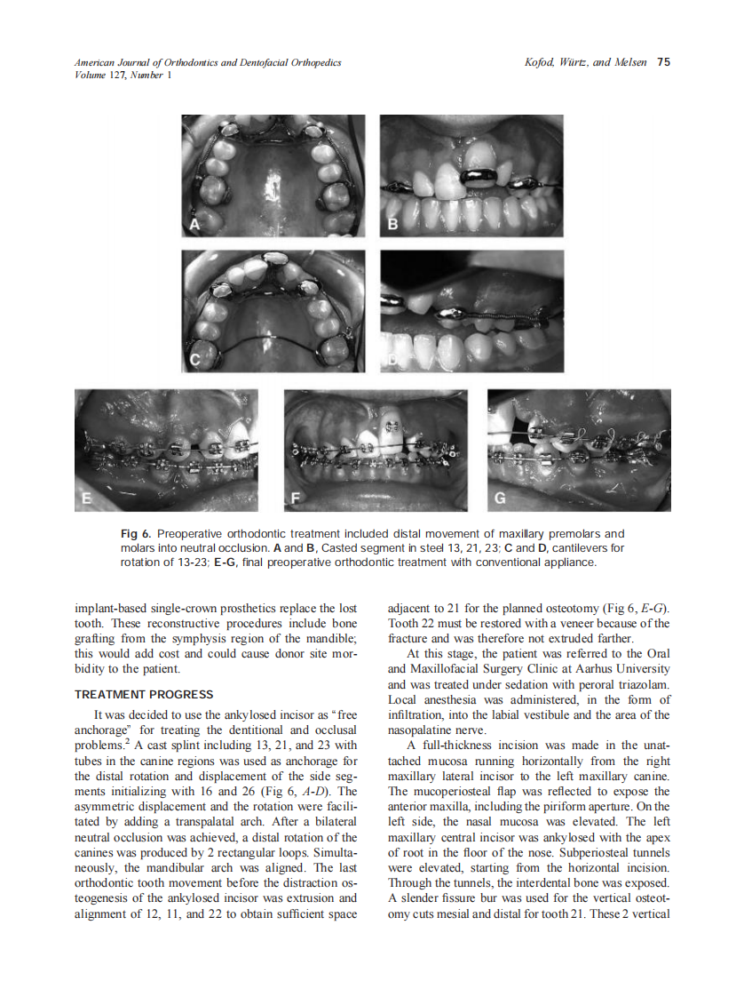 2005_127_1_72_80_Kofod.pdf 第4页