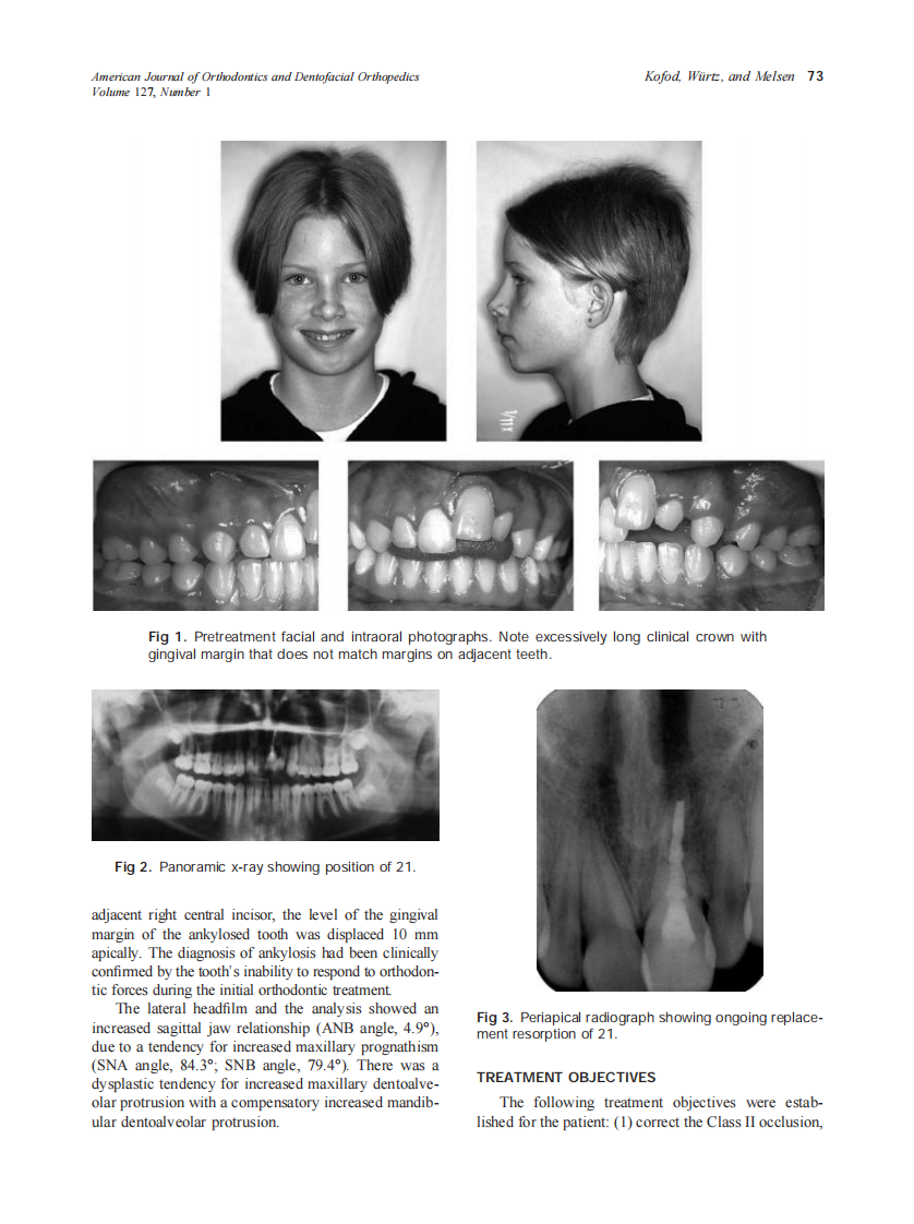 2005_127_1_72_80_Kofod.pdf 第2页