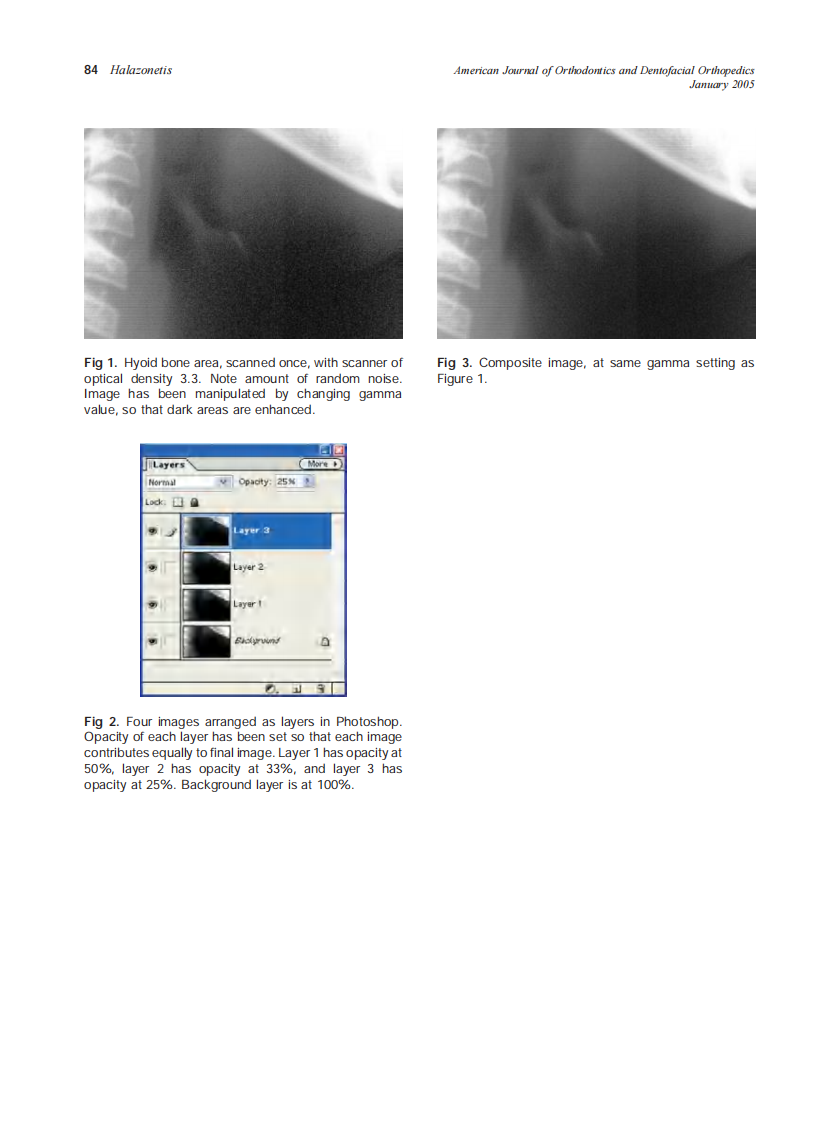 2005_127_1_83_84_Halazonetis.pdf 第2页