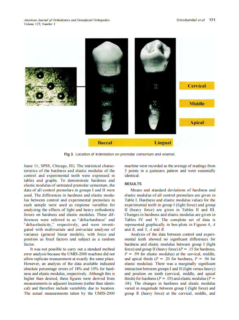 2005_127_2_168_176_Srivicharnkul.pdf 第4页