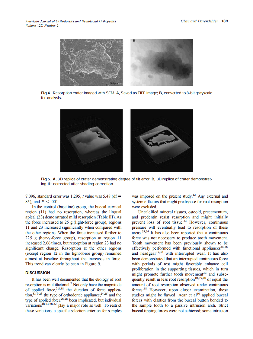 2005_127_2_186_195_Chan.pdf 第4页
