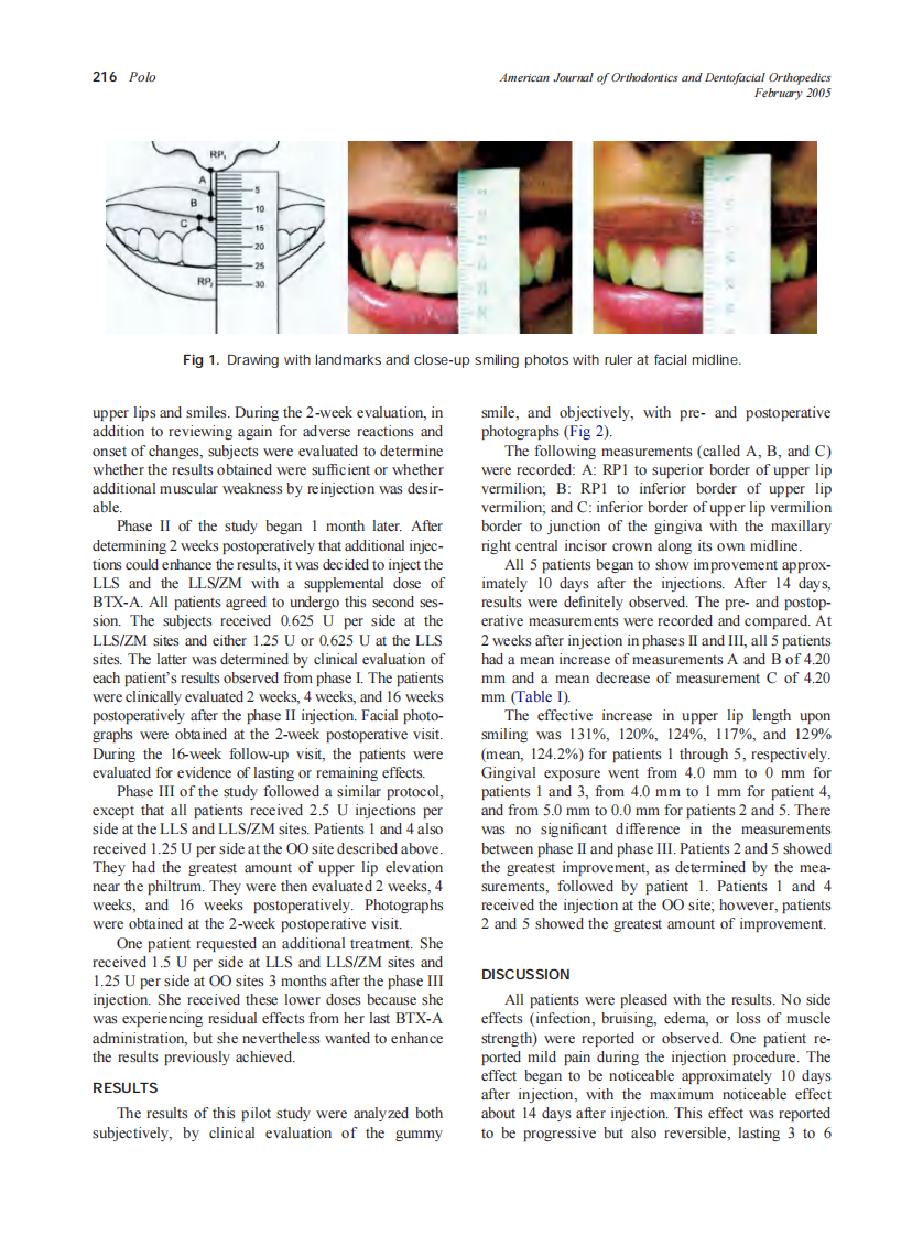 2005_127_2_214_218_Polo.pdf 第3页
