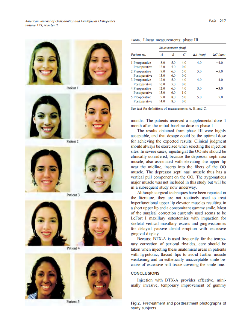 2005_127_2_214_218_Polo.pdf 第4页