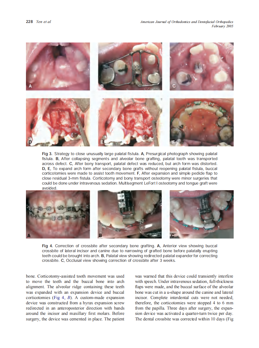 2005_127_2_224_232_Yen.pdf 第5页