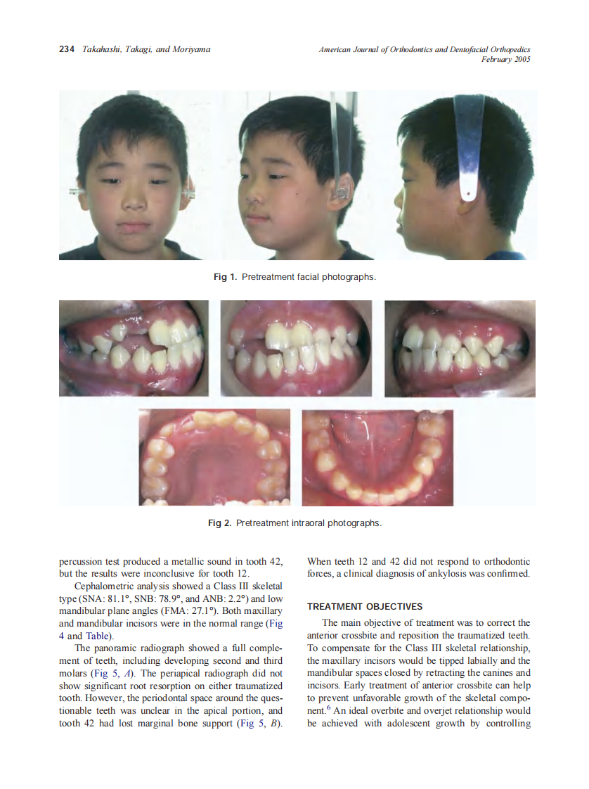 2005_127_2_233_241_Takahashi.pdf 第2页