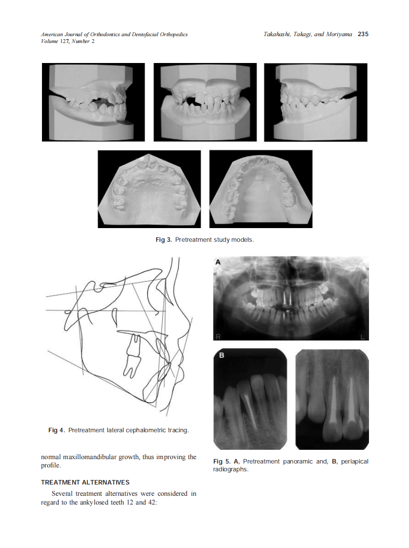 2005_127_2_233_241_Takahashi.pdf 第3页