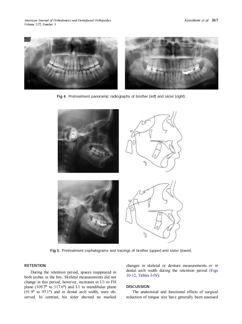 2005_127_3_364_373_Kawakami.pdf 第4页