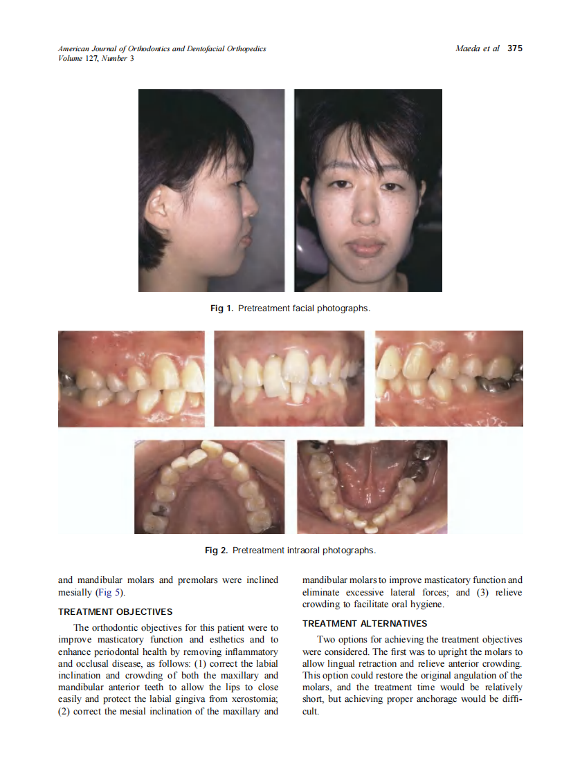 2005_127_3_374_384_Maeda.pdf 第2页