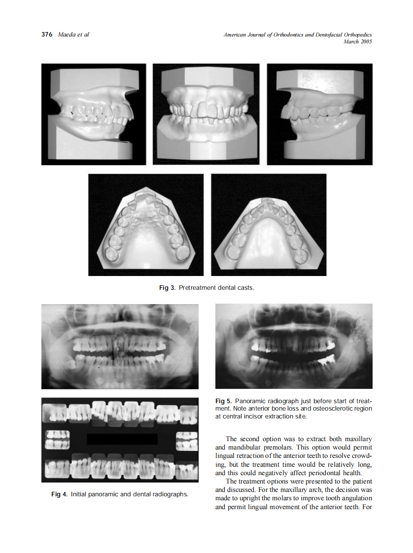 2005_127_3_374_384_Maeda.pdf 第3页