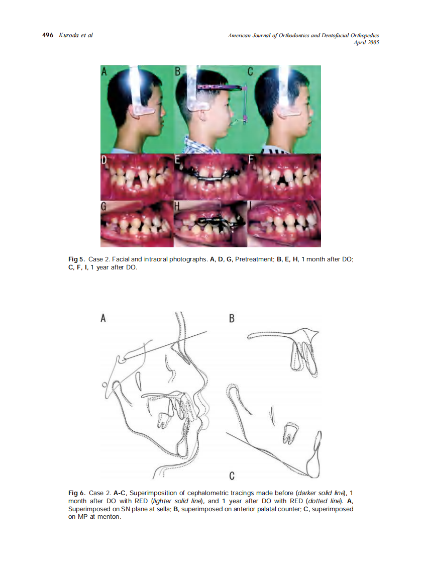 2005_127_4_493_498_Kuroda.pdf 第4页