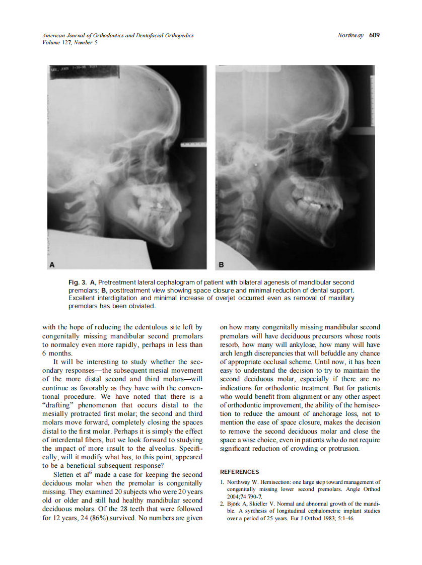 2005_127_5_606_610_Northway.pdf 第4页