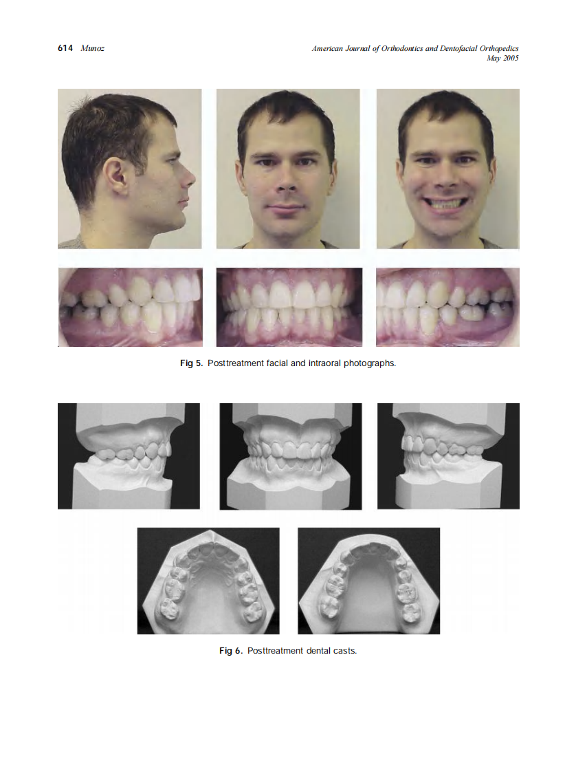 2005_127_5_611_617_Munoz.pdf 第4页