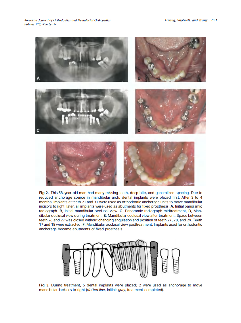 2005_127_6_713_722_Huang.pdf 第5页