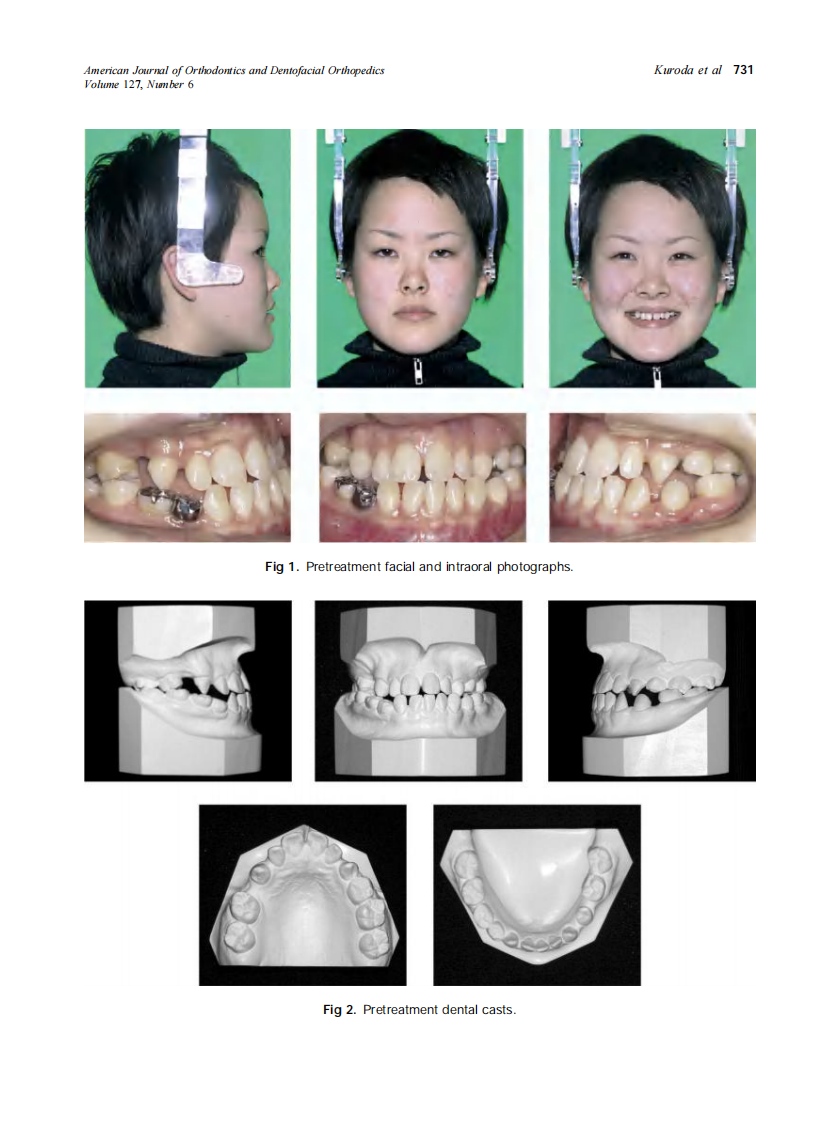 2005_127_6_730_738_Kuroda.pdf 第2页