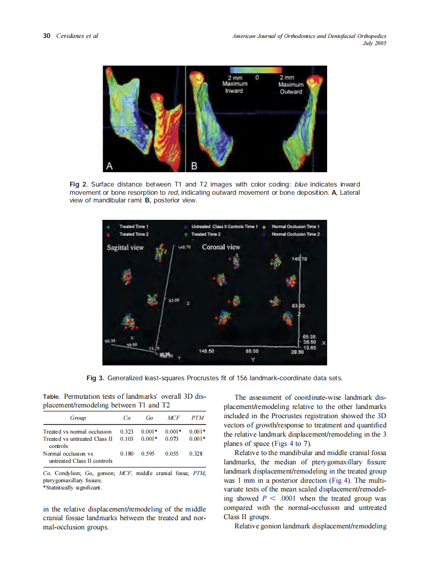 2005_128_1_27_34_Cevidanes.pdf 第4页
