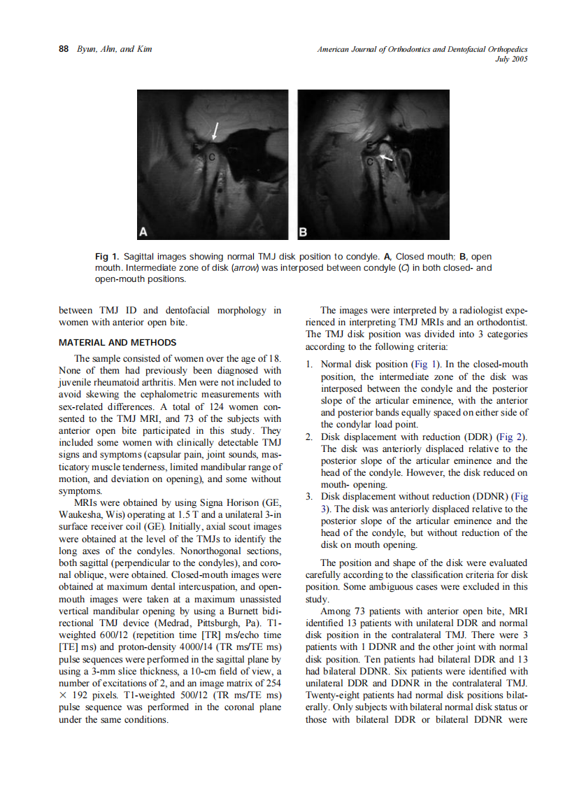 2005_128_1_87_95_Byun.pdf 第2页