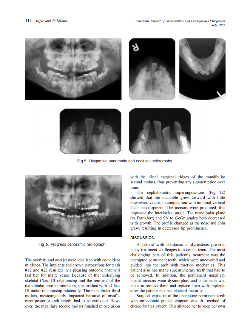 2005_128_1_110_117_Angle.pdf 第5页